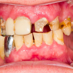 YellowMethTeeth's Avatar'