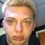 Sgt._Braphog's Avatar'