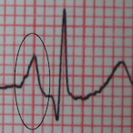 Holy Kyran's Avatar'