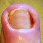 Soggytoenail1's Avatar'