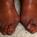 ur.sisters.toes's Avatar'