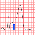 TheYolksOnYou's Avatar