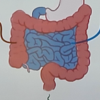 IargerIntestine's Avatar'
